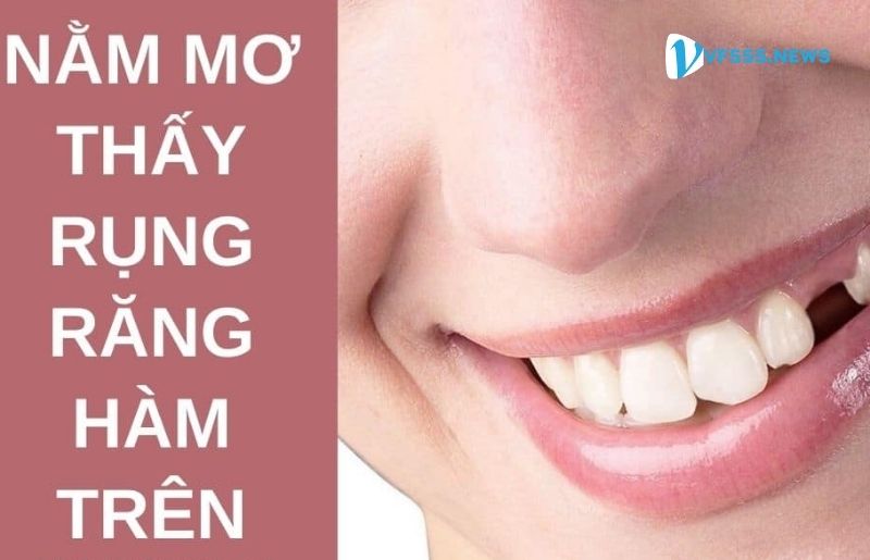 Giấc mơ bị rụng răng hàm trên có ý nghĩa gì