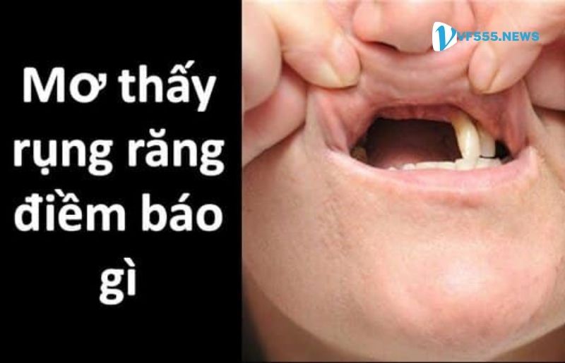 Nằm mơ bị rụng răng điềm báo tốt hay xấu?